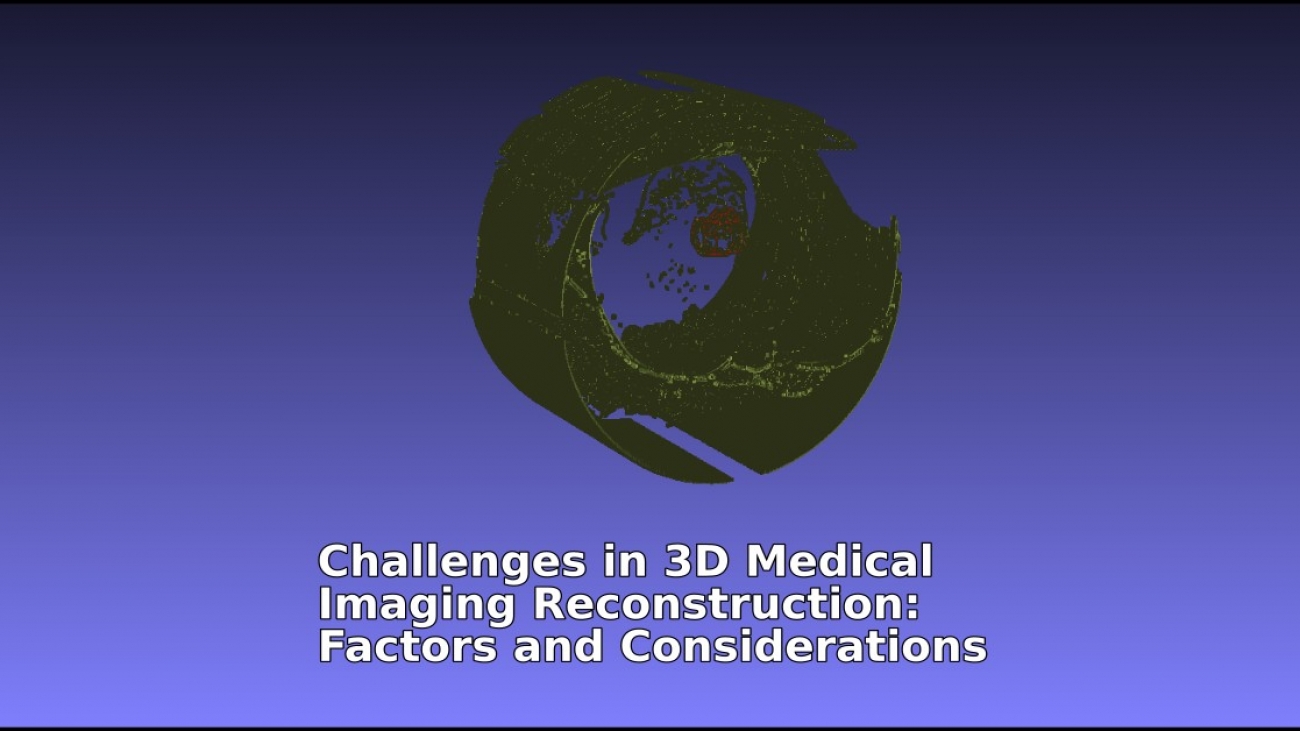 3D medical imaging, image reconstruction, diagnostic imaging, medical image processing, imaging algorithms, medical imaging software, CT scan imaging, MRI imaging, radiological imaging