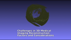 3D medical imaging, image reconstruction, diagnostic imaging, medical image processing, imaging algorithms, medical imaging software, CT scan imaging, MRI imaging, radiological imaging