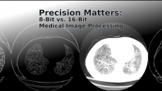 Medical Image Processing, Image Processing, Medical Imaging, Precision, python code, medical diagnostic, Acute Myeloid Leukemia (AML), Leukemia, Cancer Imaging, Cancer diagnostic